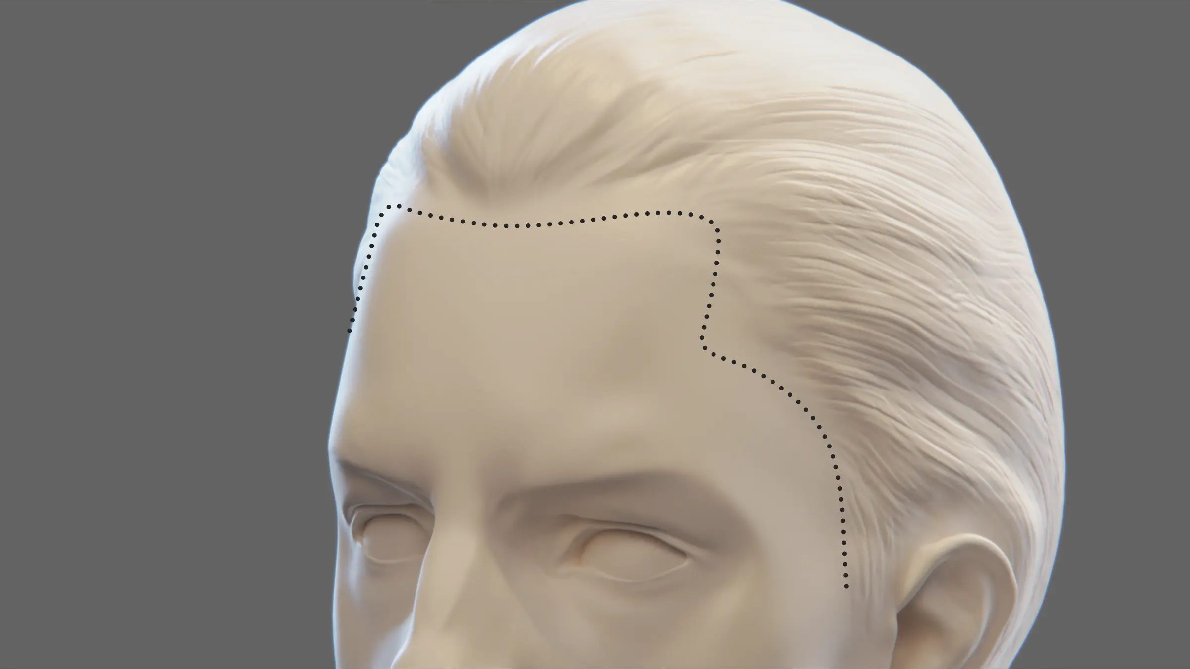 alt4