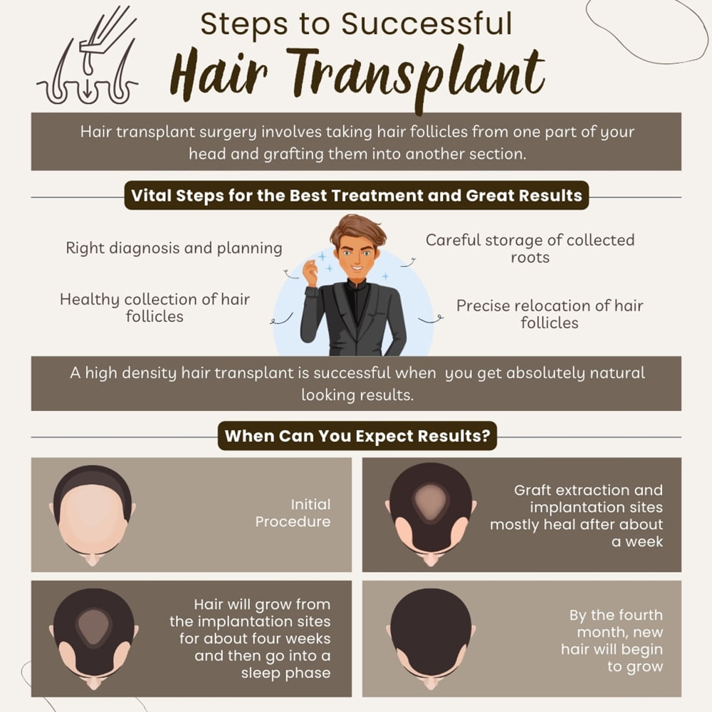 Steps To Successful Hair-Transplant